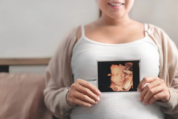 Foto de topo de uma mulher grávia apoiando a imagem de ultrassom 3D do seu feto em cima da barriga.